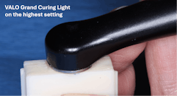 Figure 4: The light beam coming from a curing light must be perpendicular to the resin surface for adequate cure, as shown on this resin sample in the mold. Figure 4: The light beam coming from a curing light must be perpendicular to the resin surface for adequate cure, as shown on this resin sample in the mold.