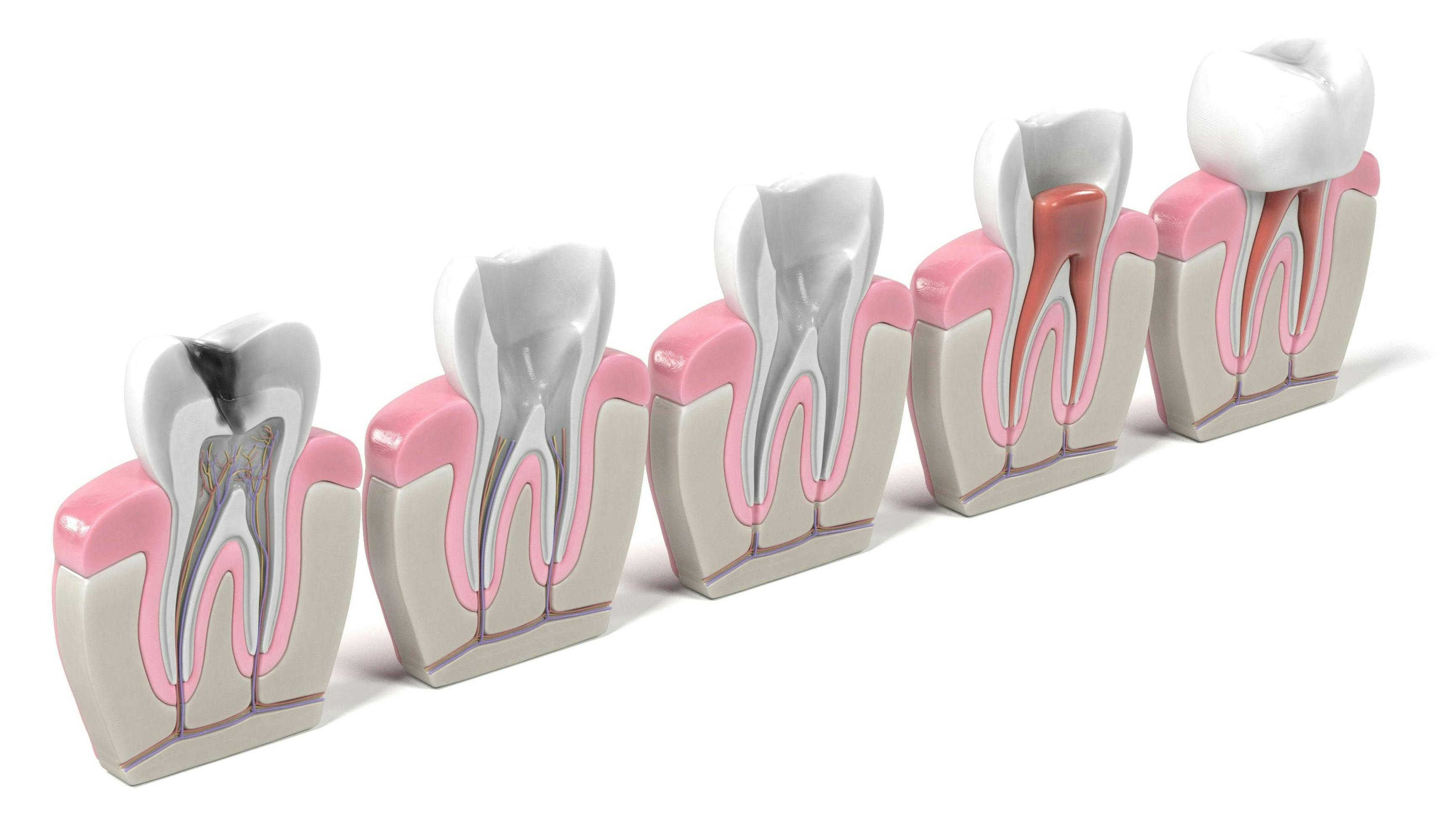 General dentists can take the time to learn proper endodontics.