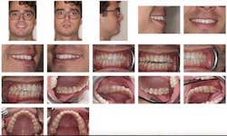 dental-photography3 dental-photography3