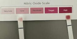 Figure 4: Patient test strip after rinsing with OxiStom (left), and same patient after rinsing with StellaLife (right)—at two different time intervals. Figure 4: Patient test strip after rinsing with OxiStom (left), and same patient after rinsing with StellaLife (right)—at two different time intervals.