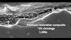 Figure 2: TRAC Research SEM photo of typical composite resin restoration shrinkage at 1,000x Figure 2: TRAC Research SEM photo of typical composite resin restoration shrinkage at 1,000x