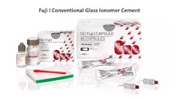 Figure 5: Examples of conventional GI cements Figure 5: Examples of conventional GI cements