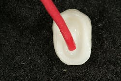 Figure 4: Pulpdent silane bond enhancer Figure 4: Pulpdent silane bond enhancer