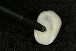 Figure 7: Load crown with Activa cement translucent Figure 7: Load crown with Activa cement translucent