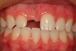 Figure 13: Pre-op Figure 13: Pre-op