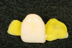 Figure 14: Etch with Porcelain Etch Gel Figure 14: Etch with Porcelain Etch Gel