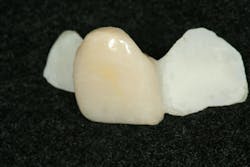 Figure 15: The restoration etched Figure 15: The restoration etched