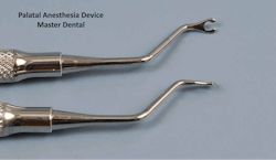 Figure 4: Placing pressure on the palate with this device or any small object causes blanching, reduced blood supply, and usually a painless injection if administered as described in this article. Figure 4: Placing pressure on the palate with this device or any small object causes blanching, reduced blood supply, and usually a painless injection if administered as described in this article.