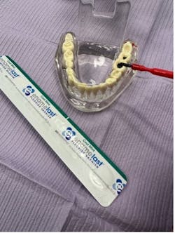 Figure 4: Apply fluoride varnish Figure 4: Apply fluoride varnish