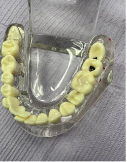 Figure 6: Final restoration Figure 6: Final restoration