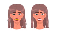 Quality before-and-after photos are great marketing tools for your dental practice. Quality before-and-after photos are great marketing tools for your dental practice.
