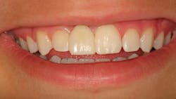 primary image primary image