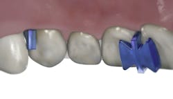 Butterfly matrix Butterfly matrix