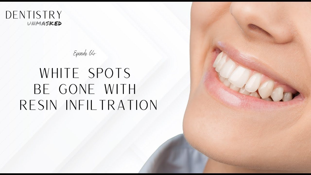 White spots be gone with resin infiltration with Dr
