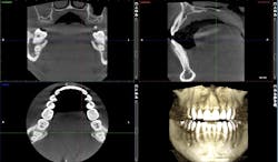 cosmetic dentistry crown lengthening cosmetic dentistry crown lengthening