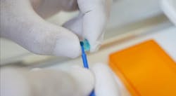 Figure 4: Conditioning the veneer with ceramic primer (Monobond Etch & Prime): rub into the surface for 20 seconds, allow to react for another 40 seconds, rinse off thoroughly. Figure 4: Conditioning the veneer with ceramic primer (Monobond Etch & Prime): rub into the surface for 20 seconds, allow to react for another 40 seconds, rinse off thoroughly.