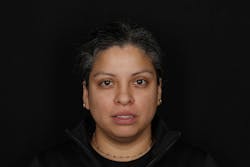 Figure 1a: Repose or lips at rest photo in full-face ... Figure 1a: Repose or lips at rest photo in full-face ...