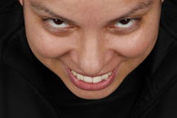 Figure 6: 12 o’clock photo. Note how we can visual incisal edge to wet-dry border of lower lip. Figure 6: 12 o’clock photo. Note how we can visual incisal edge to wet-dry border of lower lip.