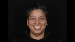 Figure 7: 2D smile design using Keynote will aid the lab in doing a 3D design. Figure 7: 2D smile design using Keynote will aid the lab in doing a 3D design.