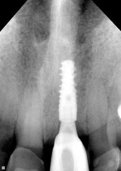 digital imaging digital imaging