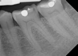 digital imaging digital imaging