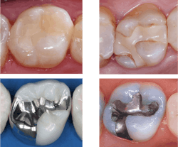 dental products dental products