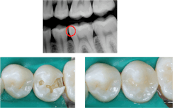 dental products dental products