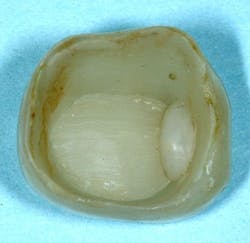 dental products dental products