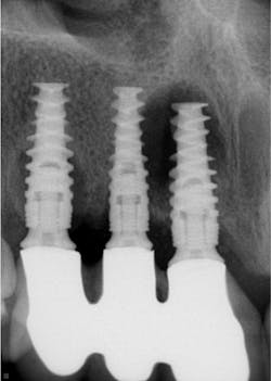 dental products dental products