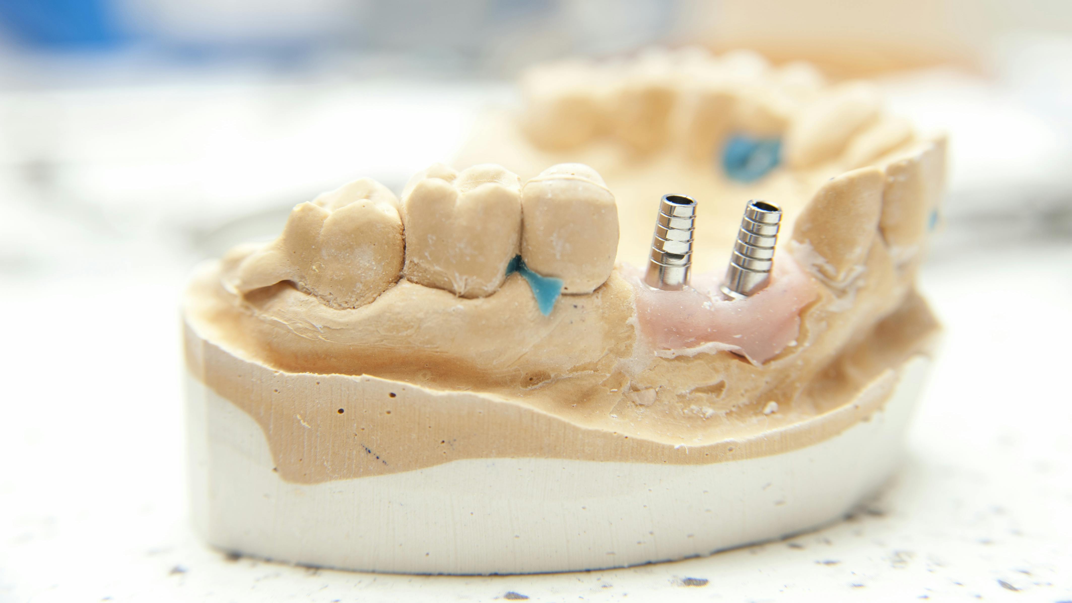 67c64161c5e80d1735ecd96a Gettyimages182166877