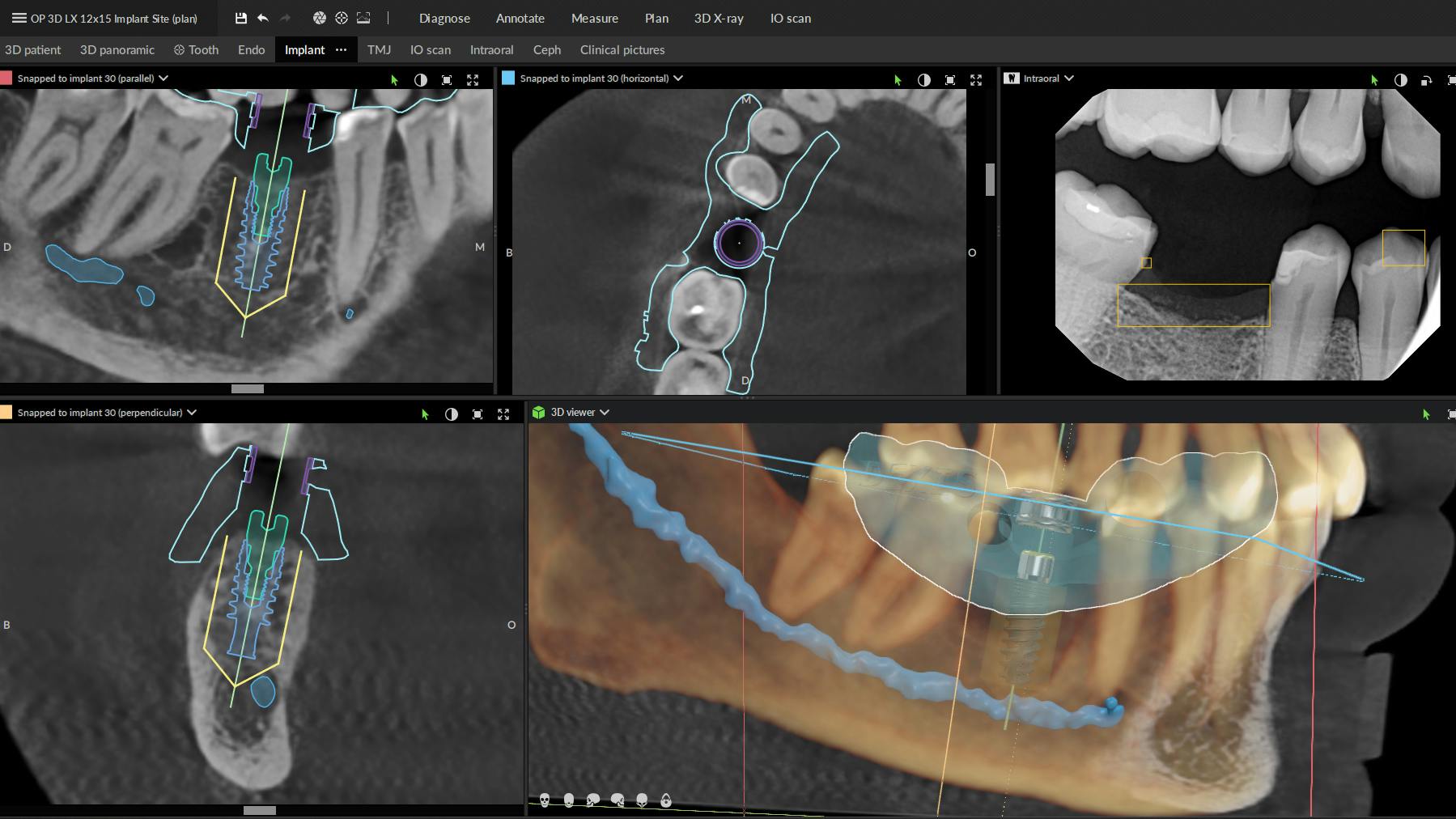 An example of how DTX Studio is able to merge and display images all in one place.