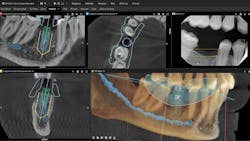 An example of how DTX Studio is able to merge and display images all in one place. An example of how DTX Studio is able to merge and display images all in one place.