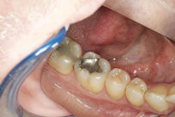 restorative dentistry restorative dentistry
