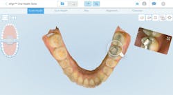 restorative dentistry restorative dentistry