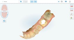 restorative dentistry restorative dentistry