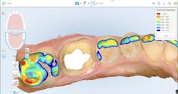 restorative dentistry restorative dentistry