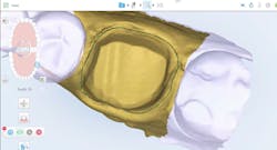 restorative dentistry restorative dentistry