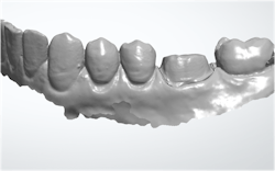 restorative dentistry restorative dentistry
