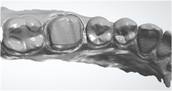 restorative dentistry restorative dentistry