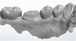 restorative dentistry restorative dentistry
