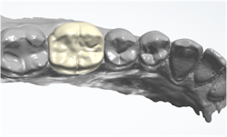 restorative dentistry restorative dentistry
