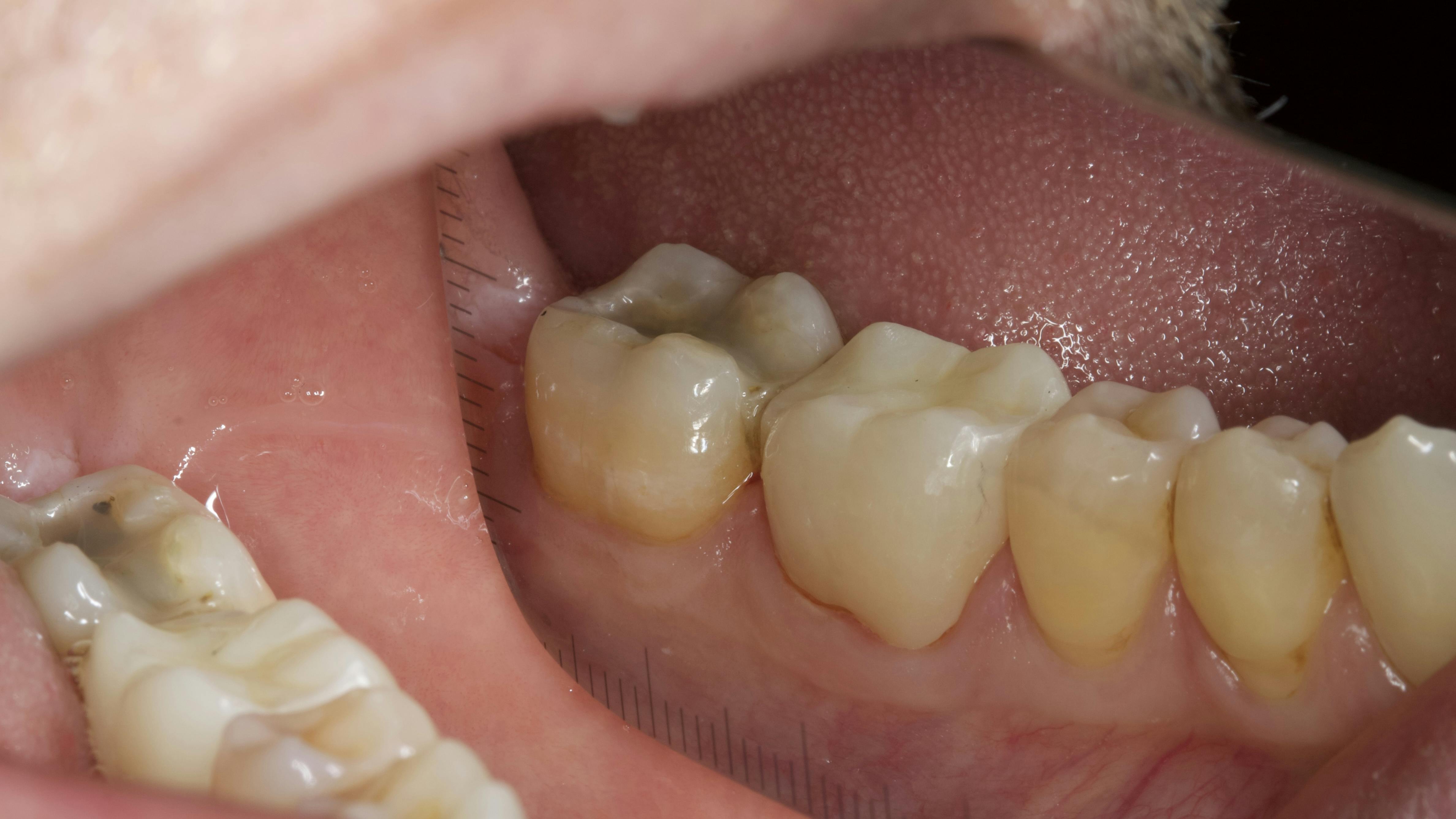 restorative dentistry