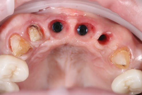 Figure 9