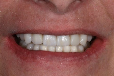 Figure 12
