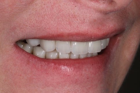 Figure 16