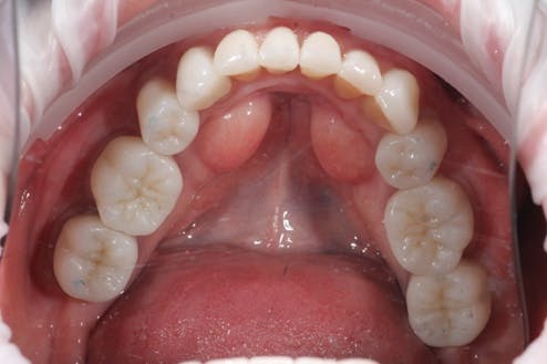 Figure 19