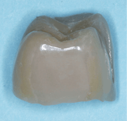 zirconia crown zirconia crown