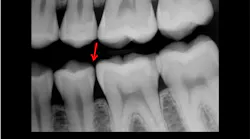 radiograph of teeth
