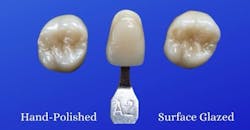 Figure 2: Hand-polished zirconia preserves anatomical detail while providing a more biologically advantageous surface. Figure 2: Hand-polished zirconia preserves anatomical detail while providing a more biologically advantageous surface.
