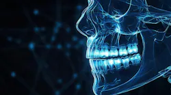 Glowing x-ray image of skull